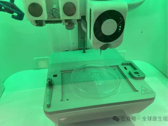 3D打印复合抗癌药将改变肝癌精准治疗